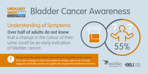 Colour urine first indication of bladder cancer