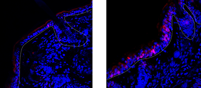 Keratinocytes cell division