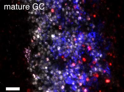 B Cells and Germinal Centers