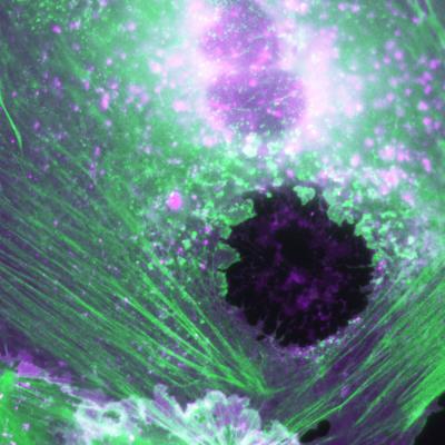 Endothelium, Heal Thyself