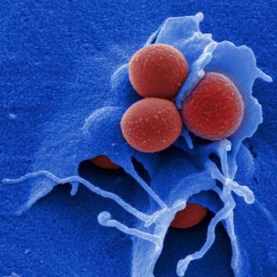 <i>Staphylococcus aureus</i>