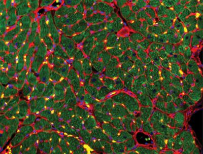 New Columbia Engineering Cell Therapy Aids Heart Recovery--Without Implanting Cells