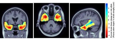 Brain Atrophy in Carriers