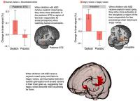 Change in Brain Signal When Children with ASD Receive Oxytocin Nasal Spray