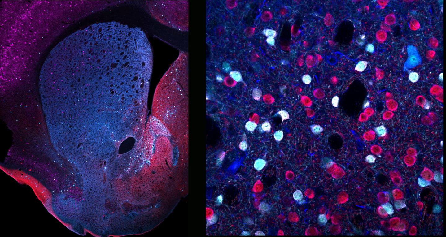 Significant differences exist among neurons expressing dopamine receptors