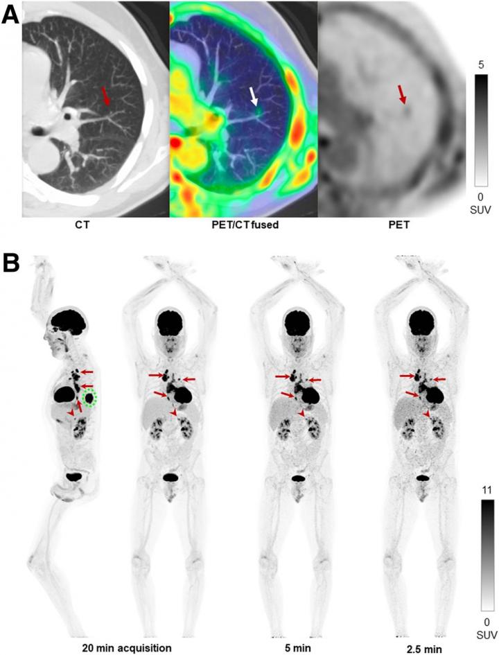 Human imaging examples of performance of uEXPLORER total-body PET scanner.