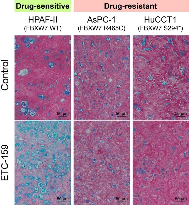 Wnt inhibitor impact on cancer cells