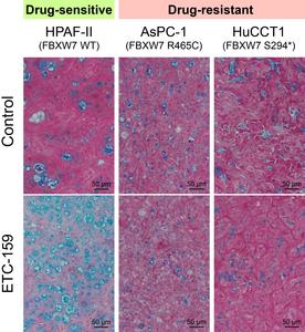 Wnt inhibitor impact on cancer cells