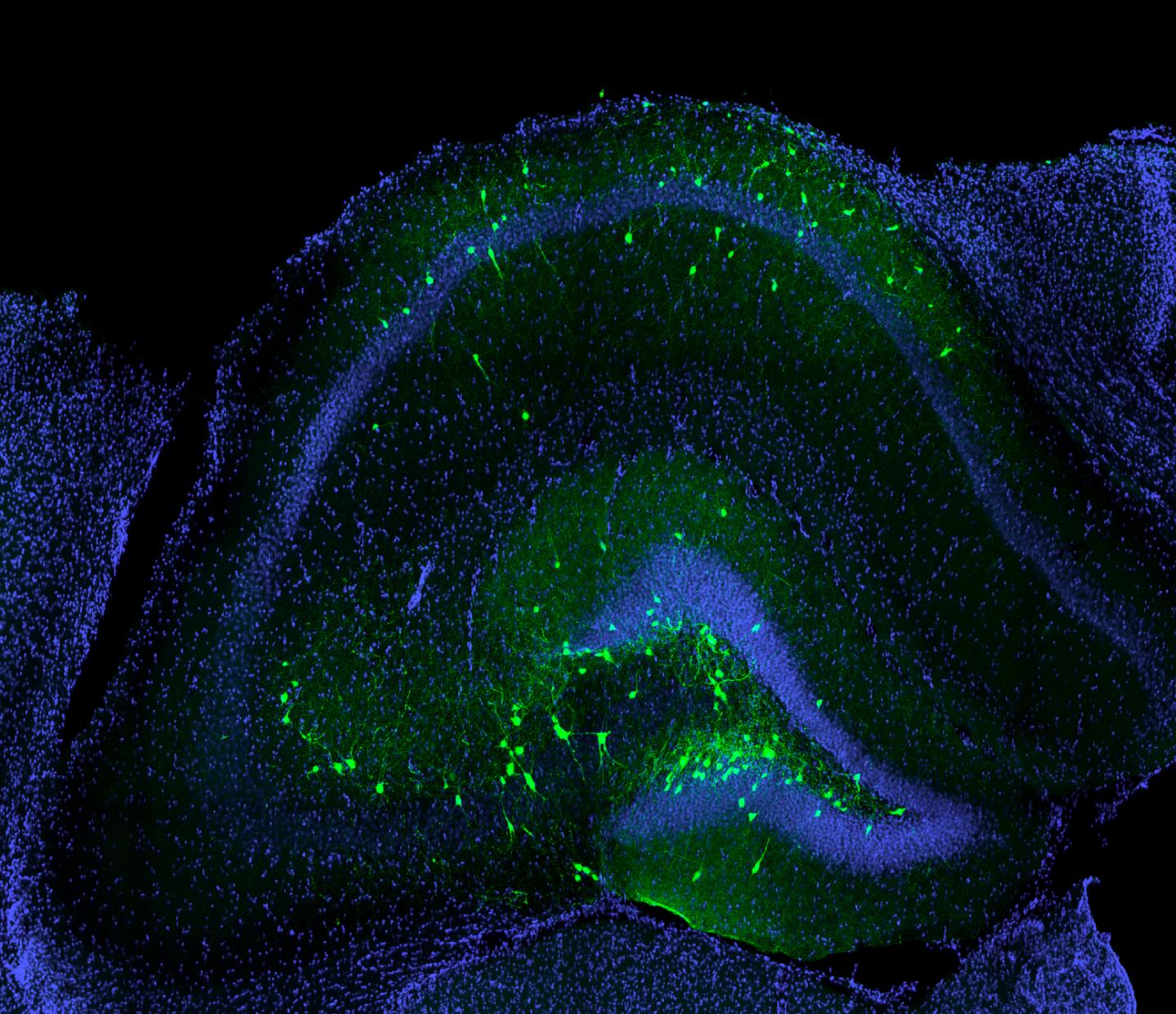 Transplanted Inhibitory Neurons