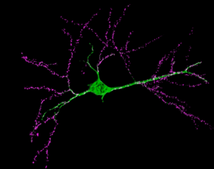 Image d'un neurone unique dans une tranche d'hippocampe de souris
