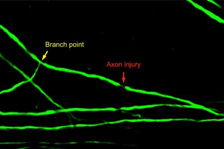 Axon Injury