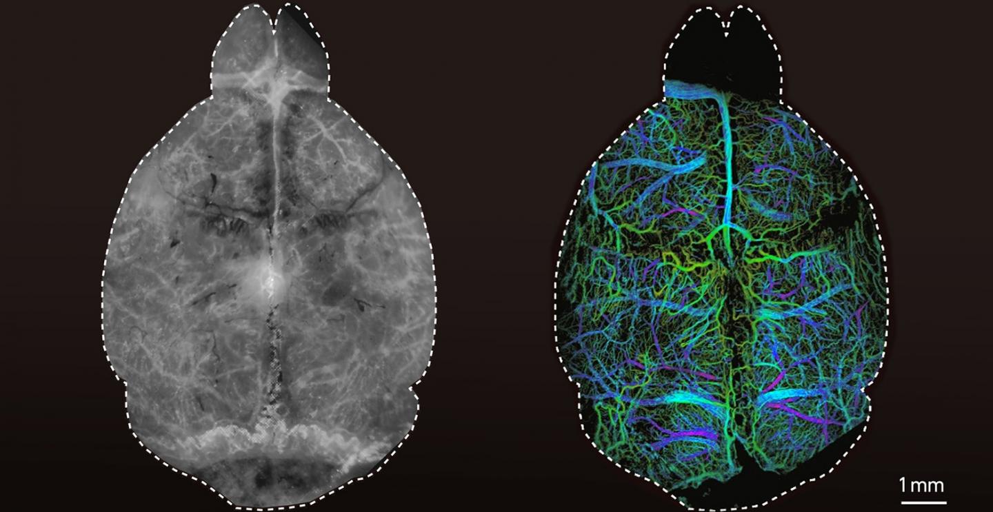 Fluorescene images of a brain