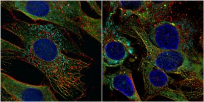 JNCL on the Protein Level