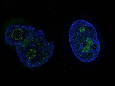 Nuclear Shape Rescue