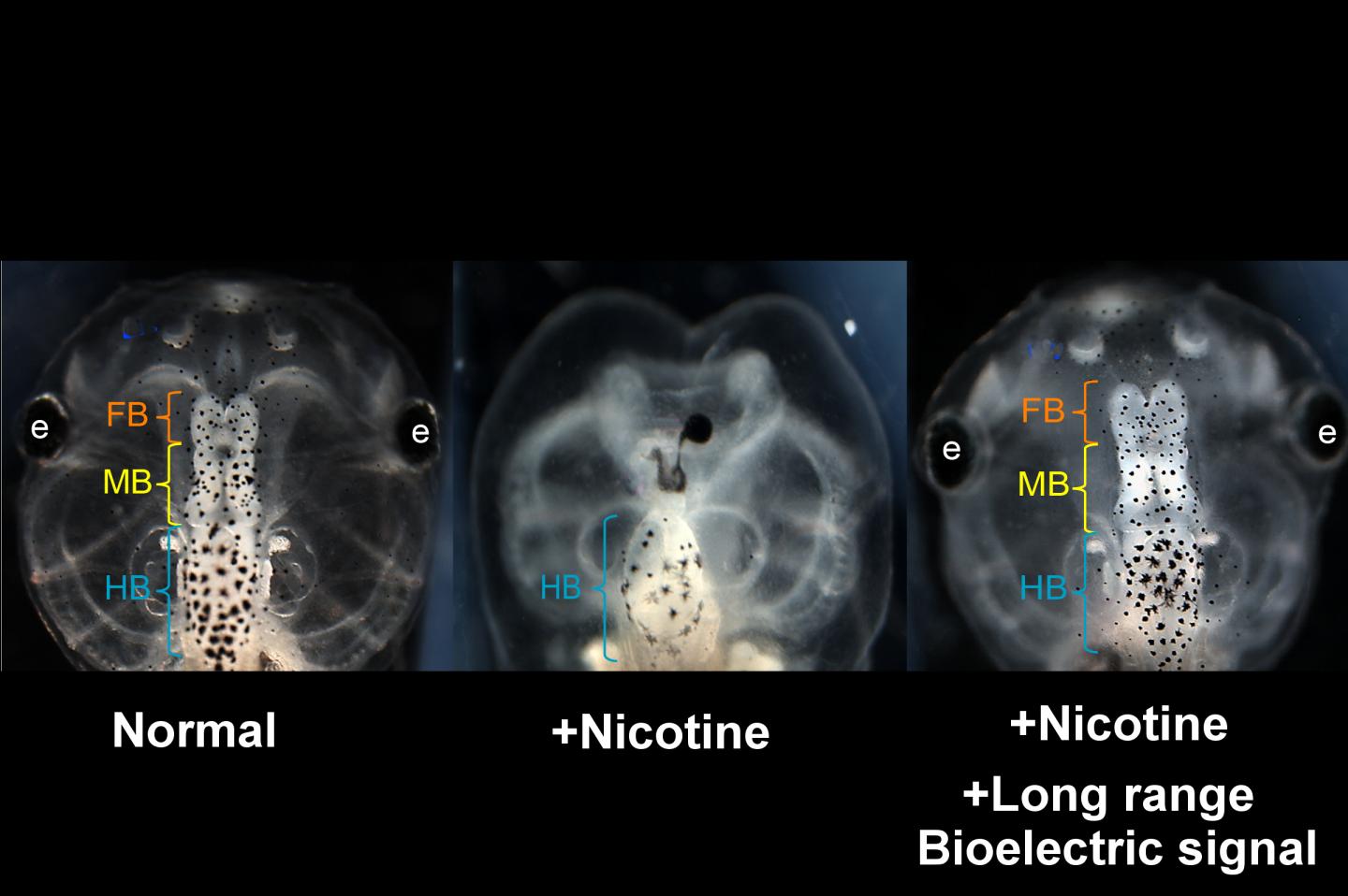 Brain defects prevented by restoring bioelectric patterns