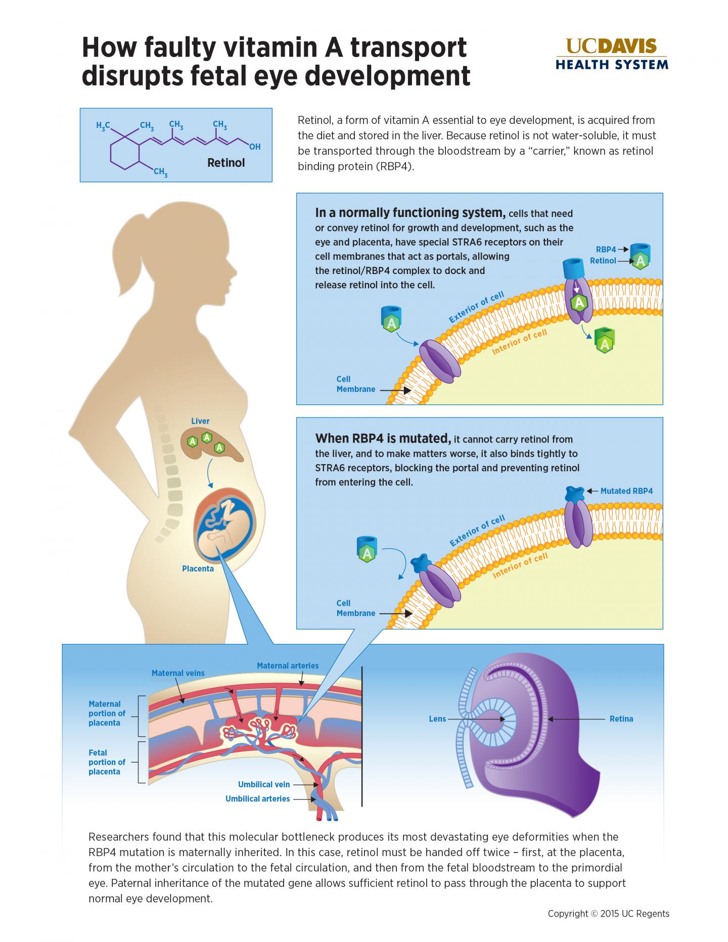 Faulty Vitamin A Transport Disrupts Fetal Eye Development
