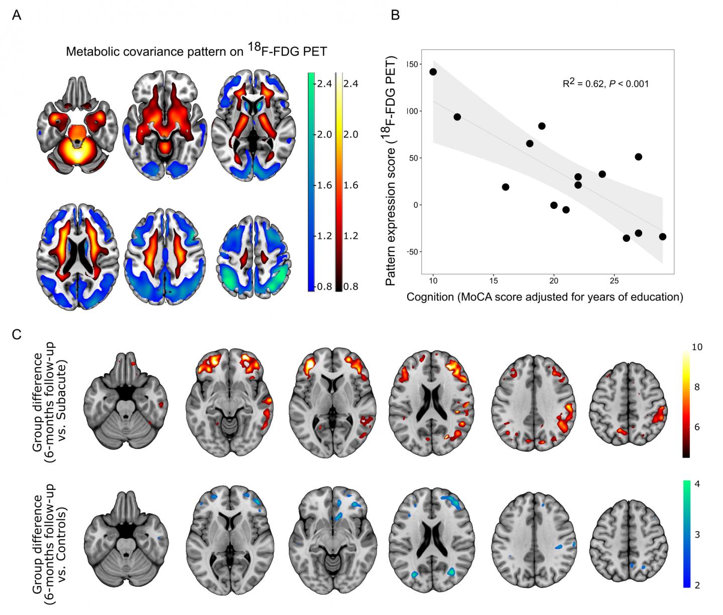 PET Imaging of Cognitive Impairment in COVID-19 Patients