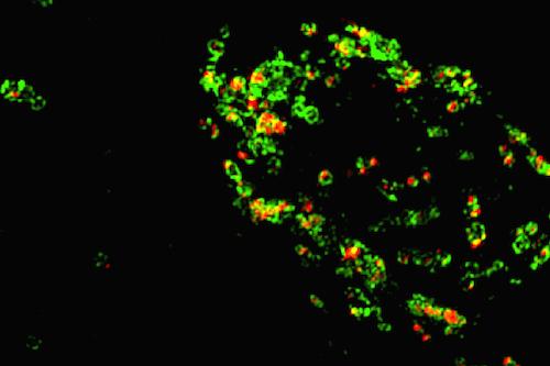 Granulins in Lysosomes