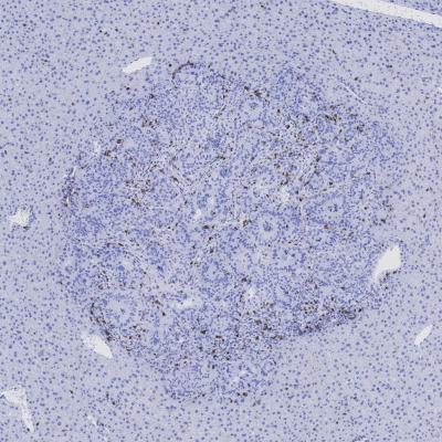 A CD3 -- Control Vehicle