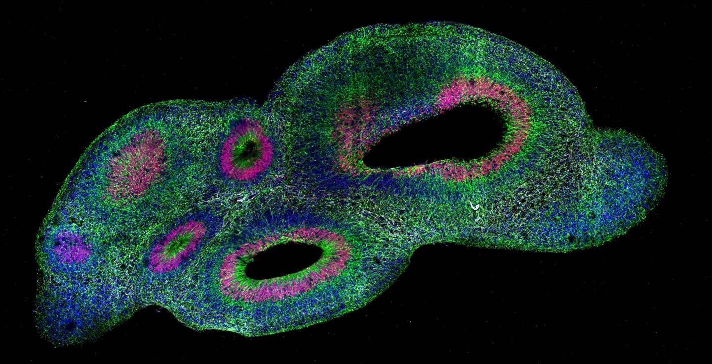 Inside an organoid