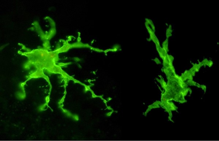 Microglia cells stained in green.