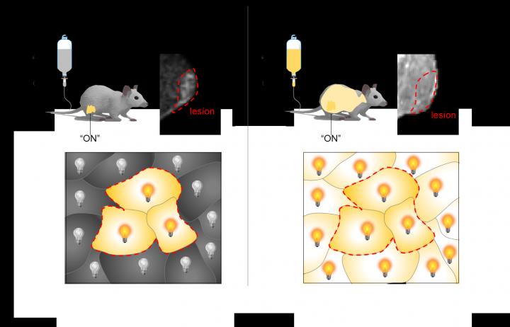 Differences between Nano MRI Lamp and the Conventional Mri Contrast Agent