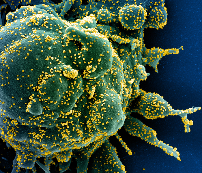Colorized scanning electron micrograph of an apoptotic cell heavily infected with SARS-COV-2 virus particles
