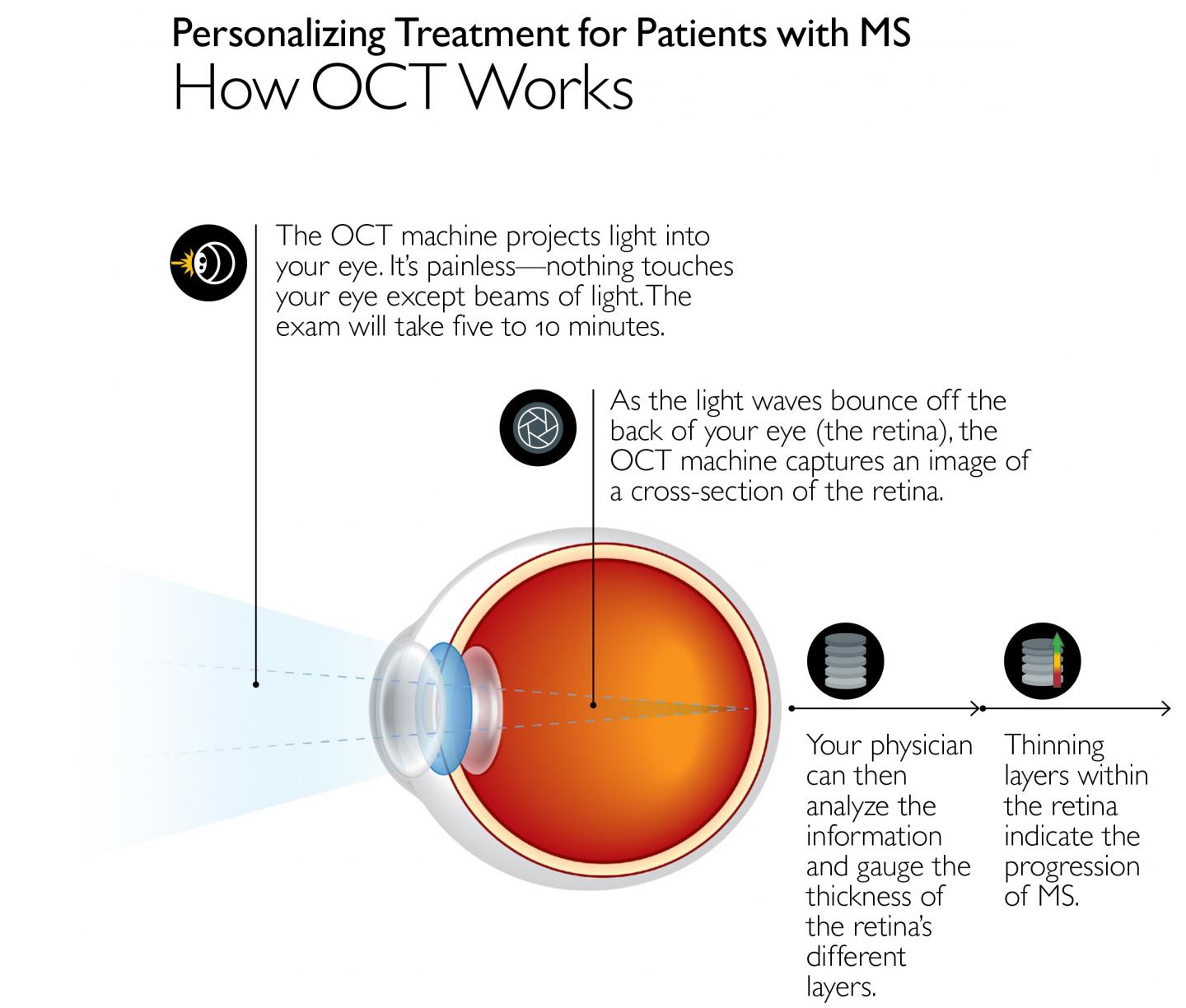 Optical Coherence Tomography [IMAGE] EurekAlert! Science News Releases