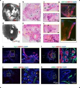 Human induced pluripotent stem cell (hiPSC)-derived skin organoids (SKOs) generate sweat and sebaceous glands when differentiated using air-liquid interface conditions.