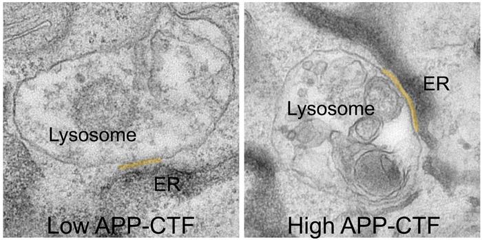 APP-C-Terminal Fragments (APP-CTFs) accumulate between the endoplasmic reticulum and the lysosomes,