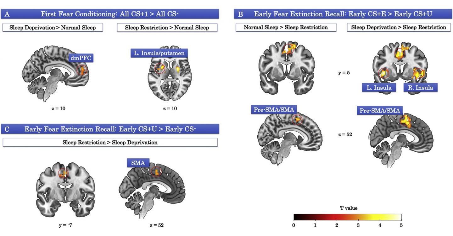 Sleep loss hijacks brain's activity during learning