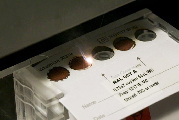 Closeup of laser cutter in malaria lab