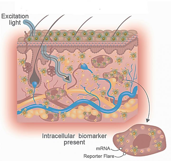 Non-Invasive Disease Detection