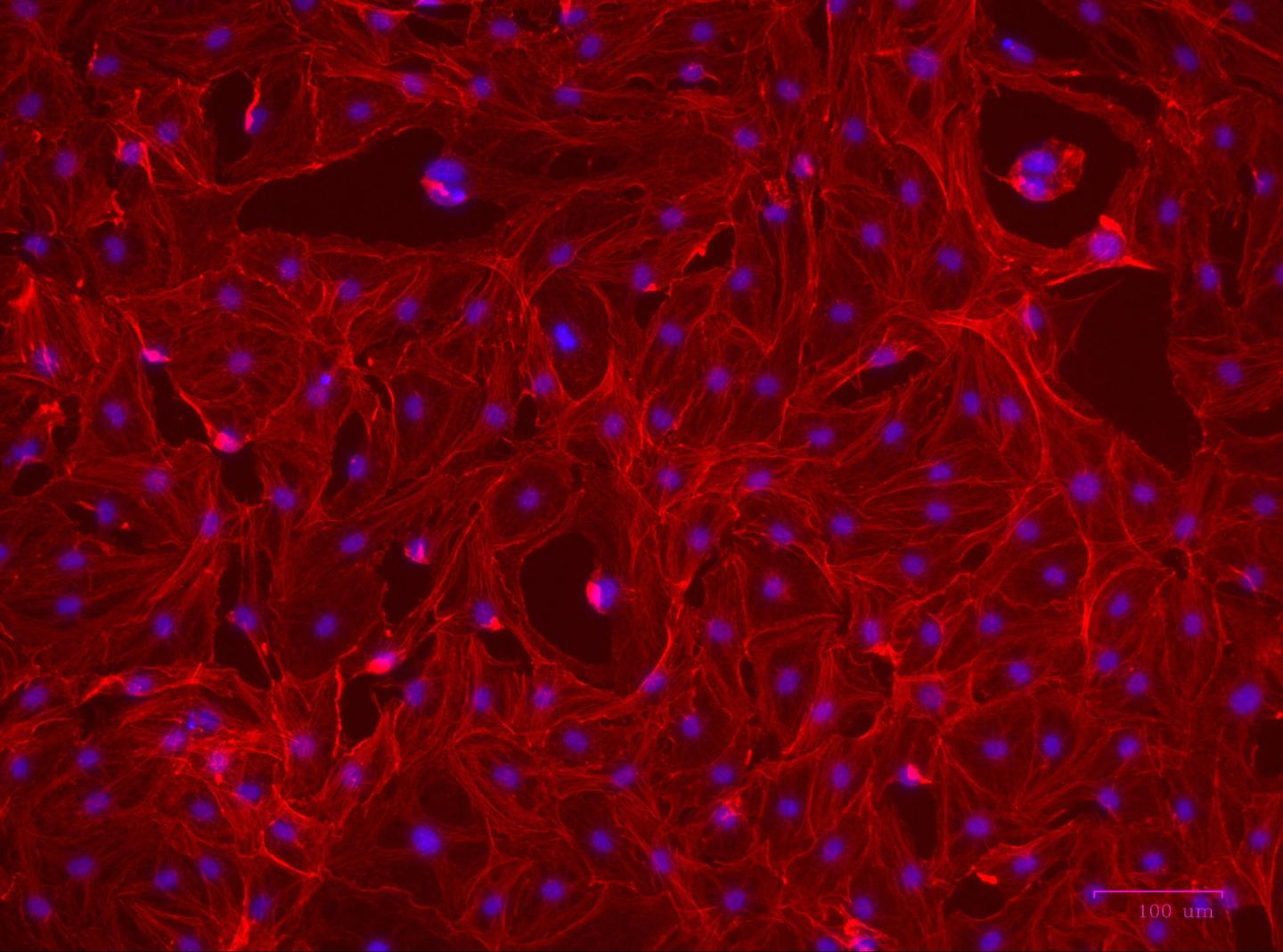 New Findings Show Promise for Treatment of Graves' Disease and Other Ocular Disorders