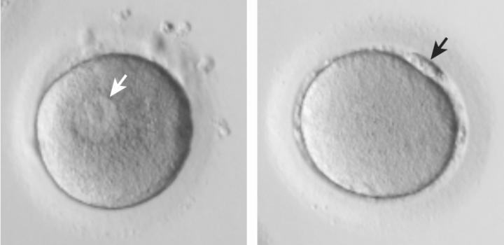 Picture of immature oocytes compared to mature oocytes