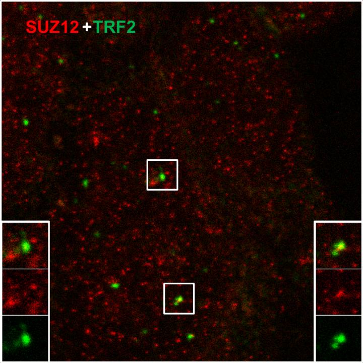 TERRAs Interact with Polycomb 2