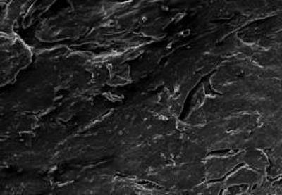 Nerve Fibers Were Poorly Arranged