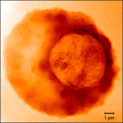 Malaria Parasite