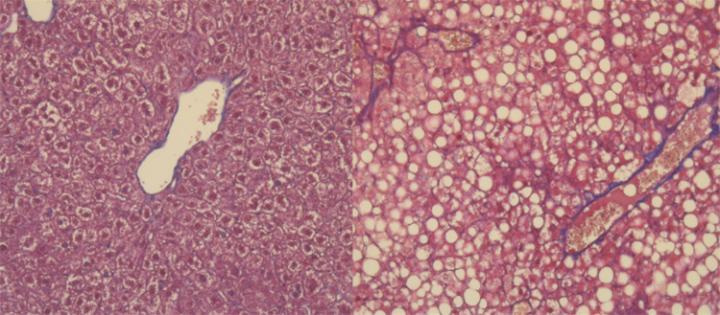 Liver Cells Under Microscopy