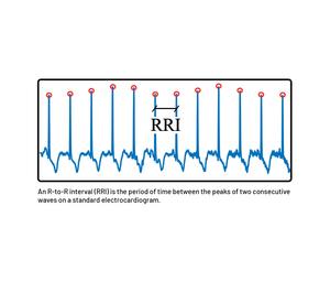 An R-to-R interval (RRI) is the period of time between the peaks of two consecutive waves on a standard electrocardiogram.