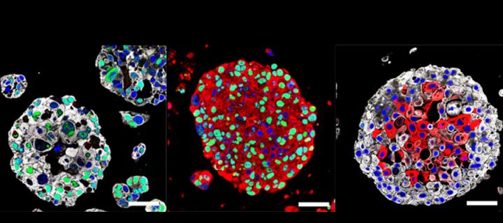 Organoids Created from Bladder Cancer Cells