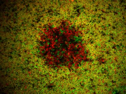 Lymphocyte Cells in Thymus