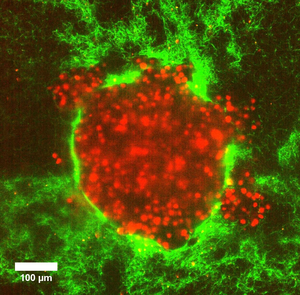 Tumour model