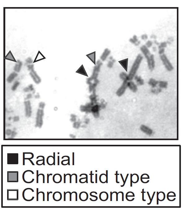 Chromosomal Aberrations Induced by Exogenous DNA Damage in DDX11 Defective Cells