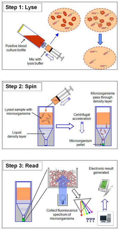 New Method to Diagnose Sepsis Is Faster, Cheaper