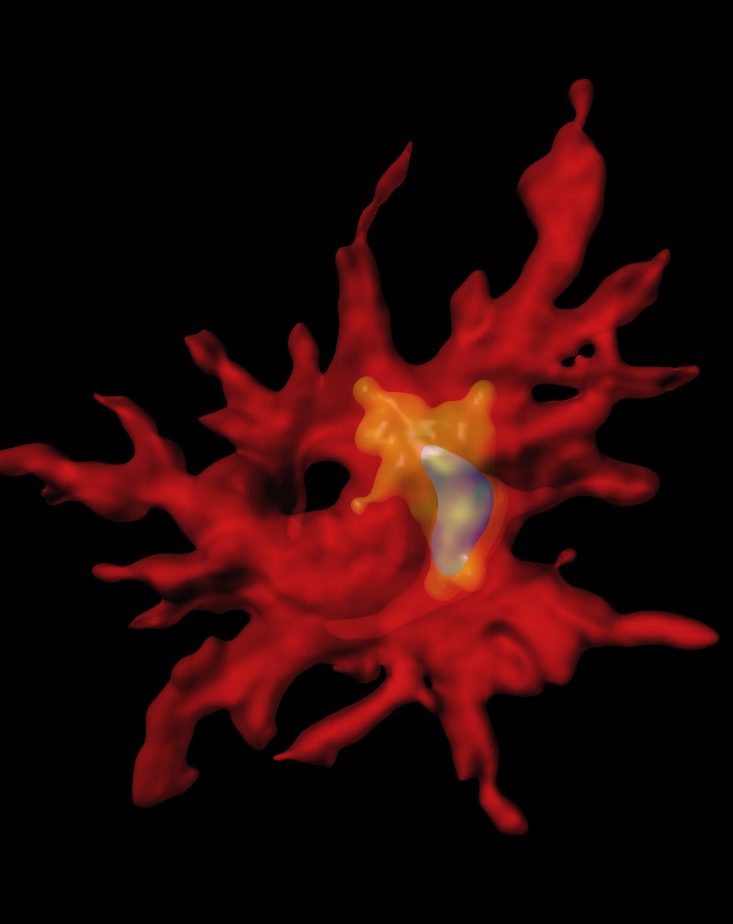 Innate Immunity Fights Against Alzheimer's