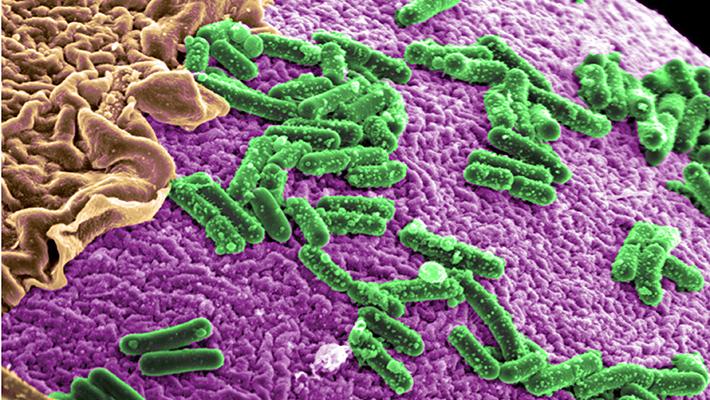 Microbial Therapy Develop to Fight Cancer
