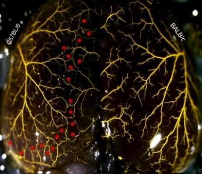 Cerebral Arterial Circulation