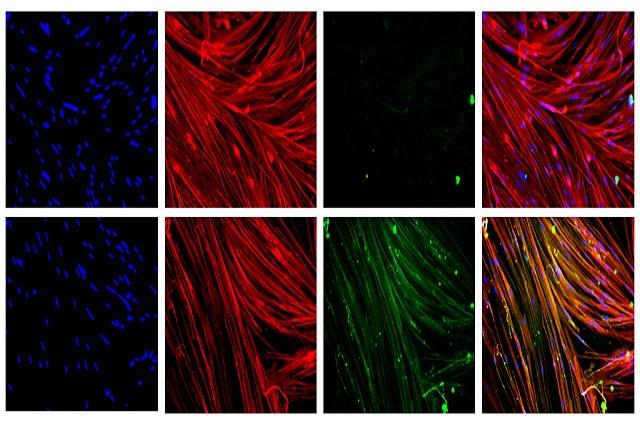 Image of Muscle Cells with and without Dystrophin