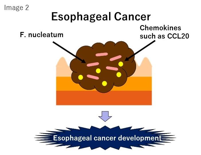 <em>F. nucleatum</em>'s Relationship to Esophageal Cancer